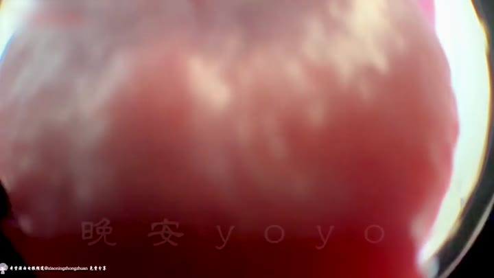 #晚安yoyo  剧情  yoyo医生为你治疗