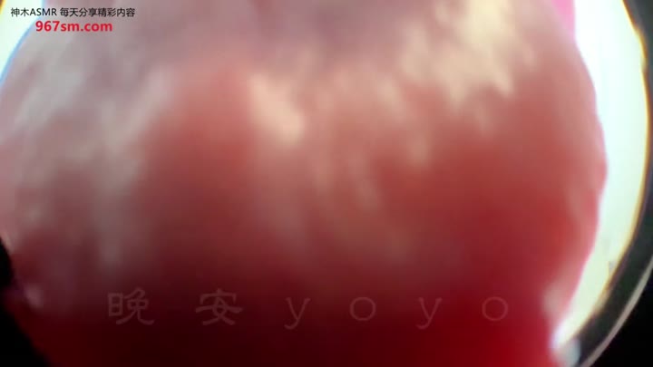 #ASMR   #晚安yoyo   yoyo医生为你治疗（一）鱼眼t p